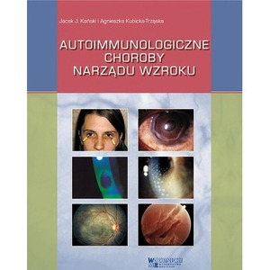 Autoimmunologiczne choroby narządu wzroku