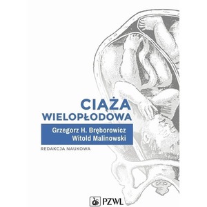 Ciąża wielopłodowa