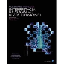 Odkrywanie radiologii: interpretacja radiogramu..