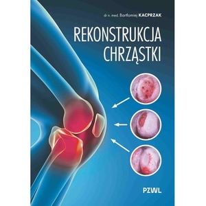 Rekonstrukcja chrząstki. Ratujemy kolano, nie wymieniamy